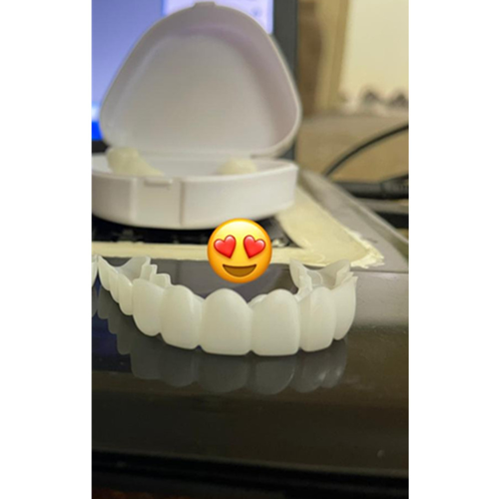 On Smile Dental Upper Lower Fa - Teeth Whitening With Braces 리뷰 및 가격