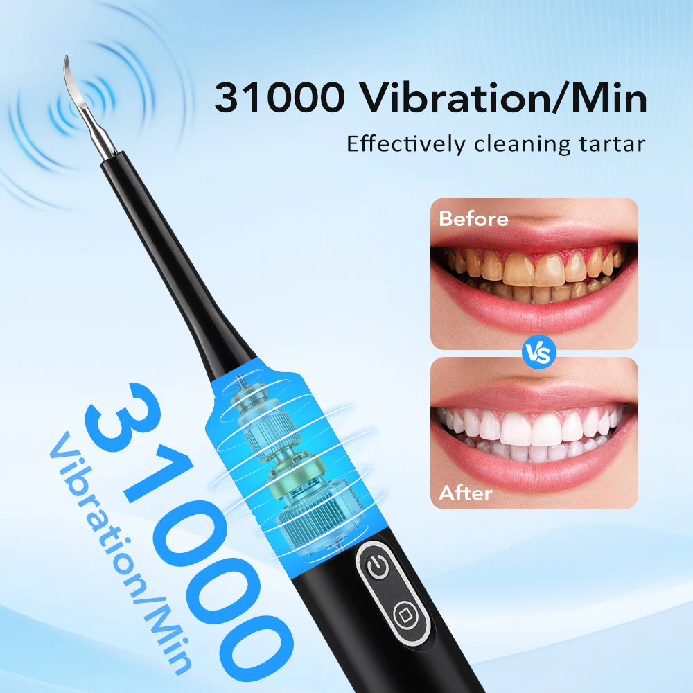 Electric Sonic Vibration Denta - Teeth Whitening Toothbrush 리뷰 및 가격