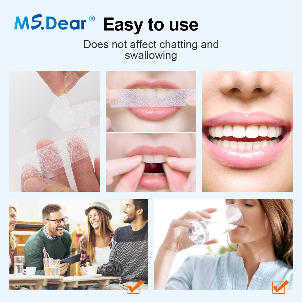 Teeth Whitening Strips Cleansi - Teeth Whitening Flash 리뷰 및 가격